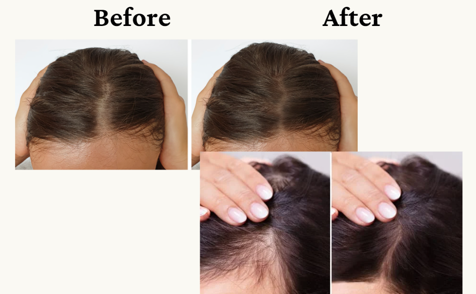 Max Growth Hair Elixir