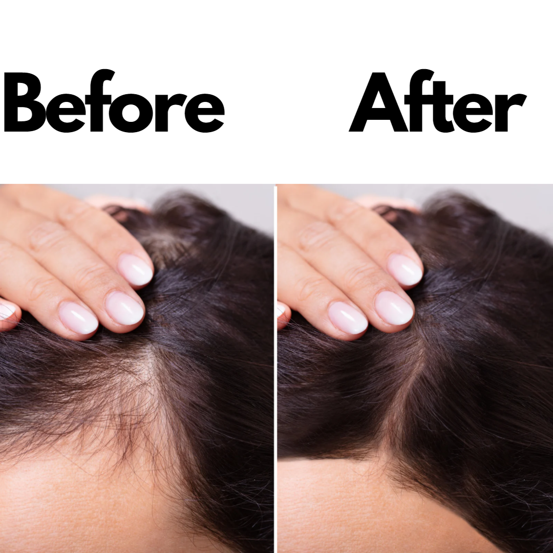 Growth+Moisture vegan hair growth set